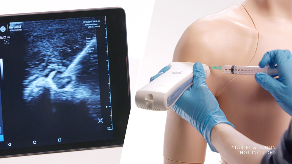 Photo: Ultrasound and anatomically accurate shoulder by Limbs & Things